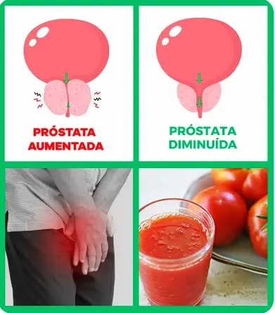Comparação próstata aumentada e diminuída